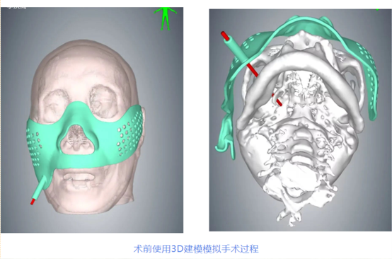 图片10.png 图片10.png