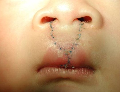 f65d0ad35357c542.jpg